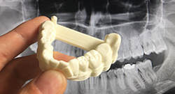 dental-prosthetics.jpg